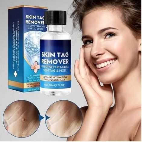Azote Liquide Anti-verrues - Traitement Efficace - 30ml