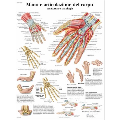 3B Scientific VR4171L Mano e Articolazione del Carpo