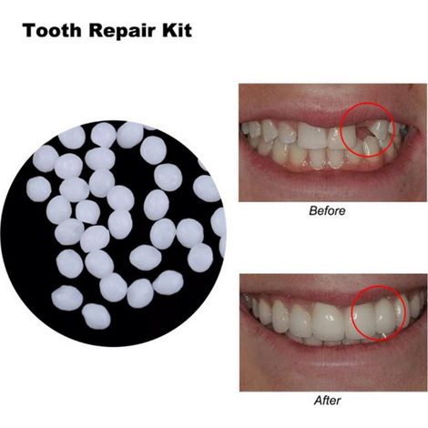 Colle à dents solide, granulés de réparation, bricolage, fausses dents de Vampire, accessoires de COSPLAY Zombie, outil de maquillage (1/5)