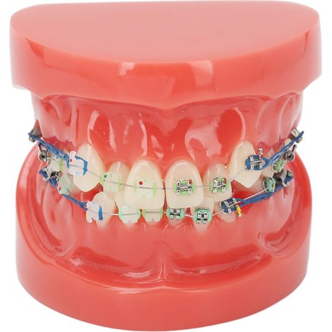 Modèle Dentaire avec Brackets Mixtes Métal/Céramique - 24 Dents avec Fils Métalliques pour Enseignement et Étude (1/5)