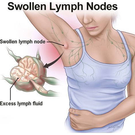 Patchs Détox Plantes pour Cou et Décolleté - Soin Lymphatique Anti-Gonflement