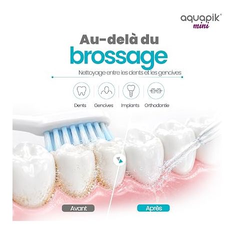 Hydropulseur Dentaire Portable Réservoir d’Eau 140 ml, Irrigateur Buccal Rechargeable USB, 4 Buses, 3 Niveaux de Puissance, Nettoyage Buccal Profondeur (1/4)