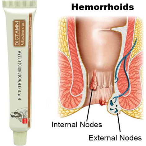 Onguent Hémorroïdes à Base de Plantes Chinoises - Crème Naturelle Anti-Hémorroïdaire Externe (1/3)