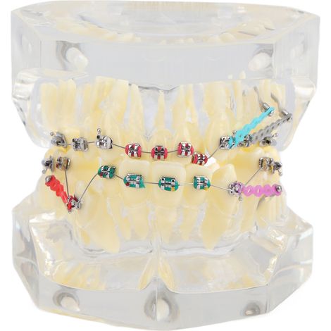 Modèle Dentaire Orthodontique avec Attache pour Correction des Dents (1/5)