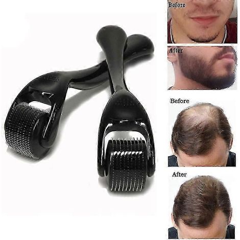 Dermalroller für Bartwuchs bei Männern - Natürliche Haarwuchsbehandlung (0,25 mm) (1/5)