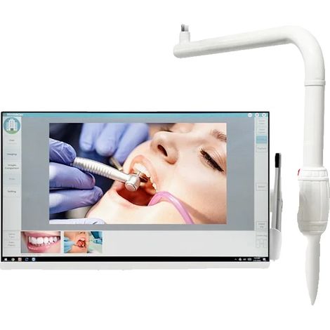 Caméra endoscopique dentaire, moniteur haute définition, connectivité sans fil, 220V Prise EU 45mm (1/2)
