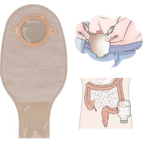 [Kolostomiebeutel] Medizinischer Beutel [ABS] Tragbarer, auslaufsicherer Stomabeutel aus Vliesstoff für Ileostomie mit kontinuierlicher Drainage (1/5)