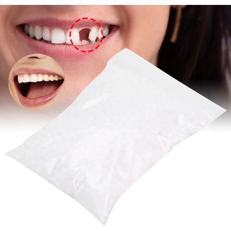 Perles de réparation dentaire temporaire pour dents manquantes ou cassées, matériau de remplissage dentaire 50g (1/5)