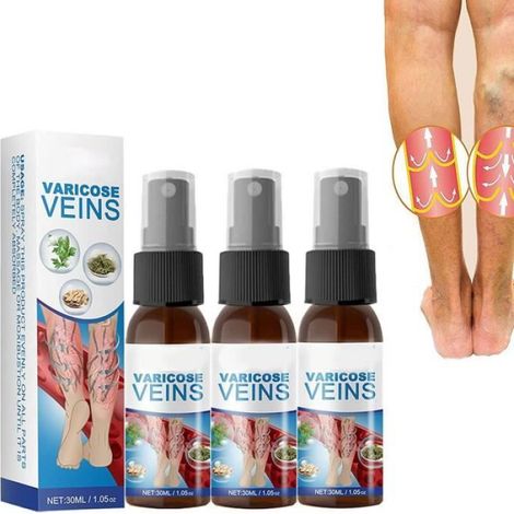 Lot de 3 sprays de traitement des varices, pour la guérison des varices, pour améliorer la circulation sanguine