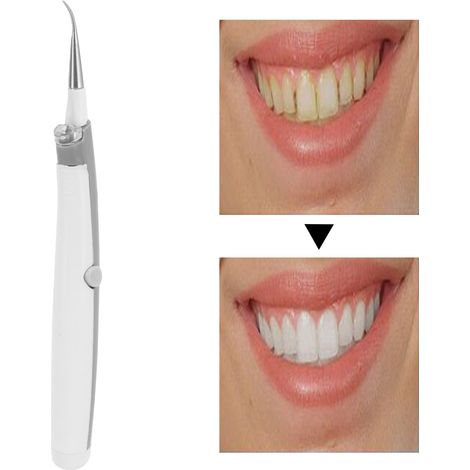 Nettoyeur de dents électrique portable pour éliminer les taches, la plaque dentaire, le tartre et les taches de café (1/5)