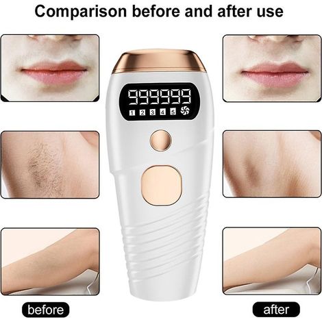 appareil D'pilation Au Laser (blanc), Appareil D'pilation Permanente Pour Peaux Sensibles, Rajeunisseur De Peau (1/3)