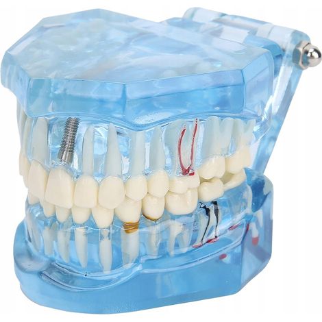 MODELO DENTAL 2 AZUL (100) GABB (1/5)