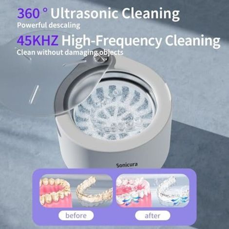 Nettoyeur d'appareils dentaires à ultrasons 45 kHz blanc, Kit de nettoyage dentaires avec brosse et pince à épiler, Bain de prothèses dentaires de 150 ml pour nettoyer les prothèses dentaires et les (1/4)