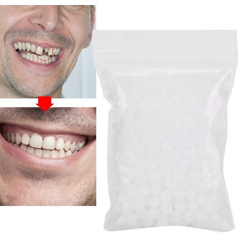 Perles de réparation dentaire temporaire, kit de comblement pour dents cassées ou manquantes, 20g (1/5)