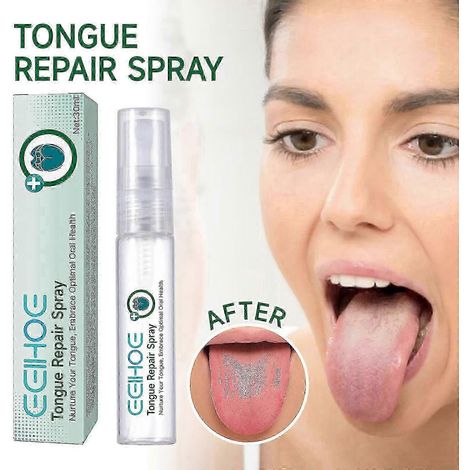 Spray réparateur pour la langue 30 ml : réduit le gonflement et soulage la mauvaise haleine. Spray réparateur pour la langue sèche et sujette à la mauvaise haleine. (1/4)