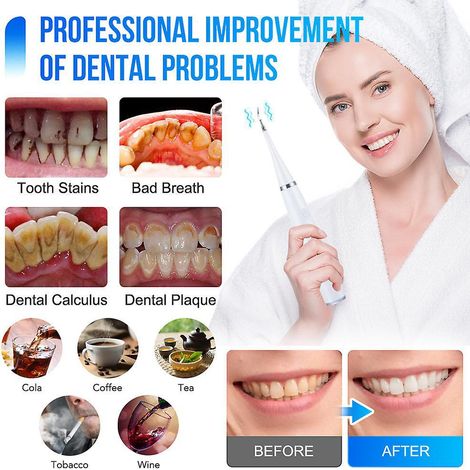dtartreur Dentaire Ultrasons Pour Les Dents Tartre Tache De Dents Calcul Dentaire Remover Lectrique Sonic Dents Plaque Cleaner Dental Stone Remov (1/5)