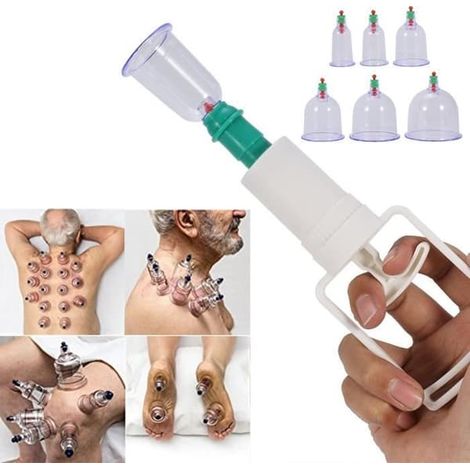 (Couleur aléatoire) Kit de massage anti-fatigue avec 12 ventouses + pistolet de massage chinois (1/4)