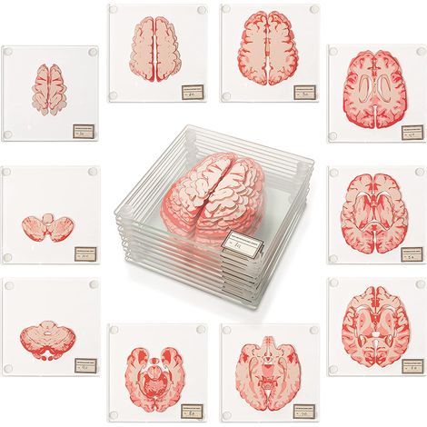 Dessous de verre anatomique en forme de spécimen de cerveau, décoration sur le thème du cerveau, cadeau original pour étudiants en médecine et amateurs d'anatomie humaine (1/5)