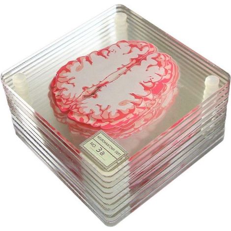 Acryl-Untersetzer mit 3D-Gehirnschnittdarstellungen - (1/5)