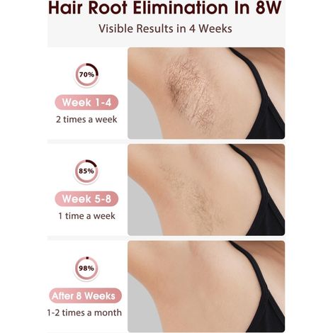 Épilation laser IPL avec système de refroidissement par la glace pour des résultats indolores et durables. - AquaForge (1/2)