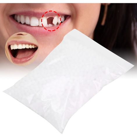 Perles de réparation dentaire temporaire pour dents manquantes ou cassées, matériau de remplissage dentaire 50g