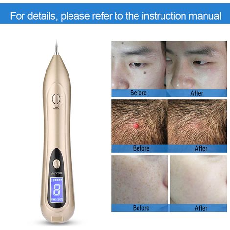 Stylo correcteur d'écran LCD USB pour enlever les taches de rousseur, les grains de beauté et les tatouages, réparation de la peau, or (1/5)