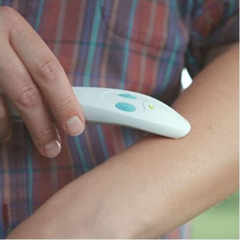 CHOYCLIT Insektenstich-Linderungsgerät, für Insektenstiche Fonepro Weiß (1/4)