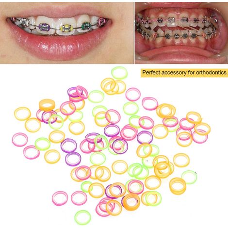 Lot de 100 élastiques dentaires professionnels en caoutchouc pour orthodontie orale, 1/8 (3,16 mm)