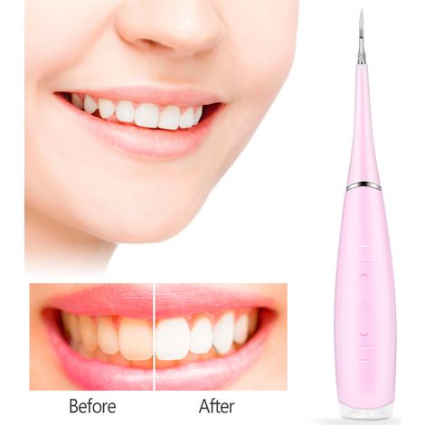 Nettoyeur dentaire électrique portable anti-tartre rose, détartreur ultrasonique pour éliminer la plaque dentaire, soin des dents, outil de blanchiment sans fil (1/5)
