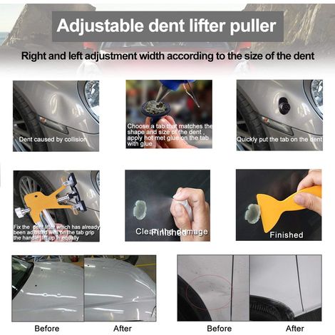 Kit de reparation bosse sans peinture elevateur reglable facile utilisation silicone resistant durable avec 18 pastilles 10 sticks colle pour voiture (1/5)
