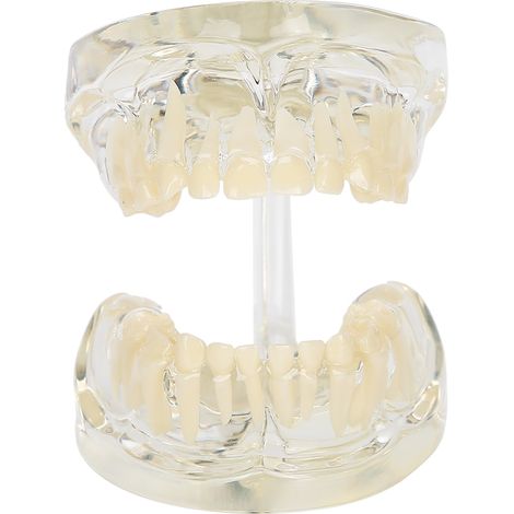 Modèle de dents de lait amovibles - Outil pédagogique pour dentiste