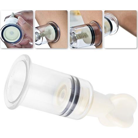 Schröpftherapie mit Schröpfgläsern zur Schmerzlinderung und Wellnessmassage (1/5)