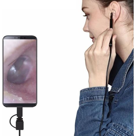 Endoscope USB pour nettoyage d'oreilles avec caméra HD (1/2)
