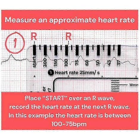 Règle ECG à 7 étapes - Outil portable d'évaluation et d'interprétation des ECG/EKG - Marque Yvan, lot de 2