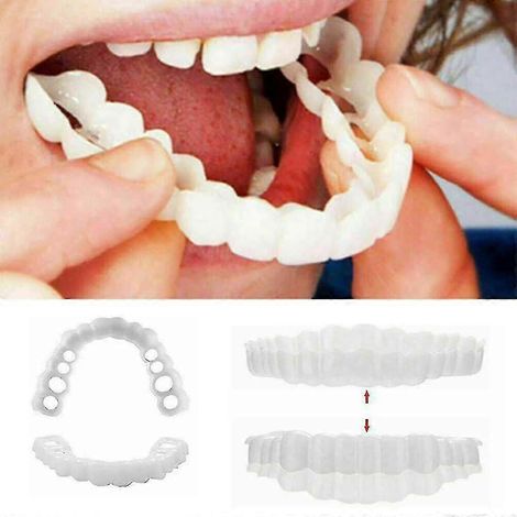 An Zahnprothesen befestigte kieferorthopädische Geräte Zahnveneers Zahnveneers Prothesenabdeckungsset (1/2)