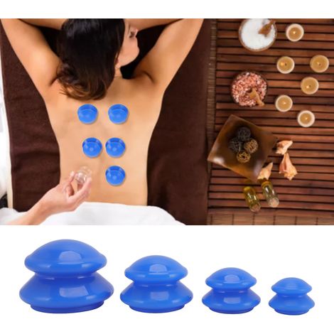 Set aus Silikon-Saugbechern in 4 verschiedenen Größen für die Unterdrucktherapie mit Vakuum, für den professionellen Einsatz im Studio oder zu Hause. Glänzende blaue Oberfläche. (1/5)