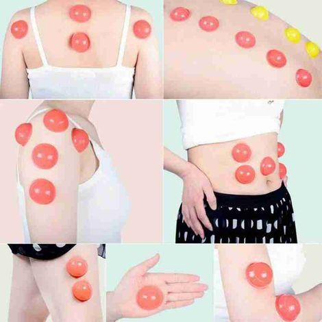 12 Pièces Ventouses de Massage en Silicone, Kit de Thérapie par Ventouses, Accessoires de Cupping Professionnel (1/2)
