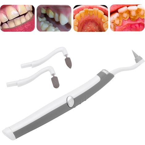 Elektrischer Zahnpolierer mit Schallvibration 500 / Jodreiniger für den Heimgebrauch zur Entfernung von Zahnstein und Verfärbungen (1/5)