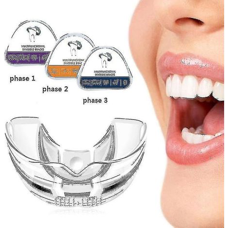appareils orthodontiques, appareils dentaires (1/5)