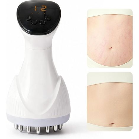 Lymphdrainage-Massagegerät und Anti-Cellulite-Massagegerät, Körperformungsgerät für Beine, Arme und Bauch, unterstützt glattere Haut (1/5)