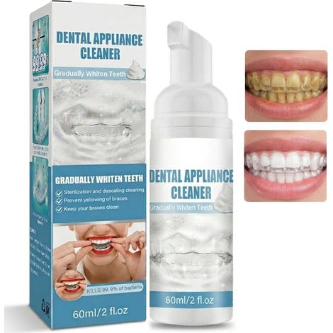 2 fl oz Orthodontic Foam Cleaner, Dental Appliance Cleaner, Dental Appliance Foam Cleaner, Portable Dental Appliance Cleaning Spray (1/5)