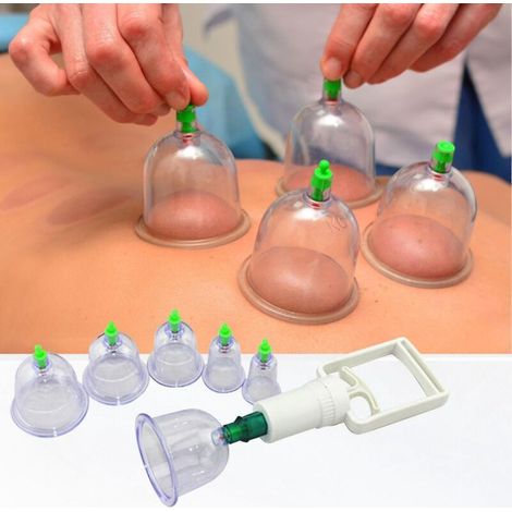 Set mit 6 Hijama-Schröpfsets inklusive Vakuumpumpe zur Körpermassage und Linderung von Rückenschmerzen und Cellulite. (1/5)