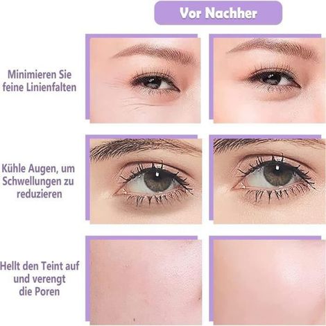 2 pcs Facial Ice Globes - appareil massage visage pour Réduit le Gonflement et les Cernes, Améliore la Circulation Sanguine (1/4)