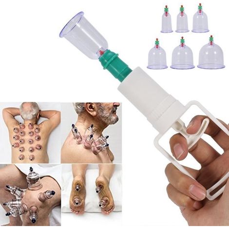 Kit de thérapie par ventouses - YES - 12 Cupping Ventouse - Pistolet d'aspiration - Anti Fatigue - Mixte (1/4)