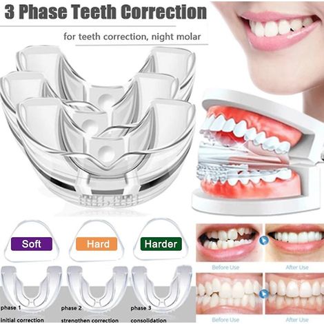 Ensemble de 3 appareils orthodontiques dentaires pour l'alignement des dents (1/4)