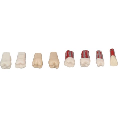 Modèle de Dents Canalaire Résine Réaliste 8 Pièces pour Étudiant en Endodontie (1/5)