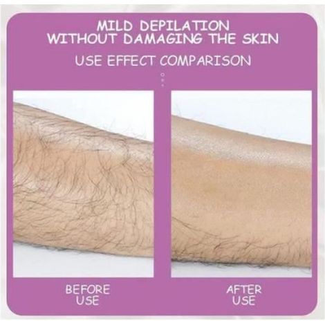Épilateur Crystal Hair Eraser - Épilation Physique Sans Rasage Ni Produit Chimique - Pour Jambes Corps Visage - Réutilisable Jusqu’à 5 Ans - 1 Pièce (1/4)