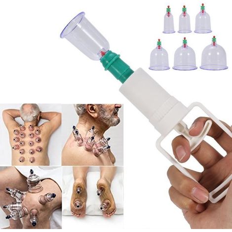 Kit de thérapie par ventouses - YES - 12 Cupping Ventouse - Pistolet d\'aspiration - Anti Fatigue - Mixte