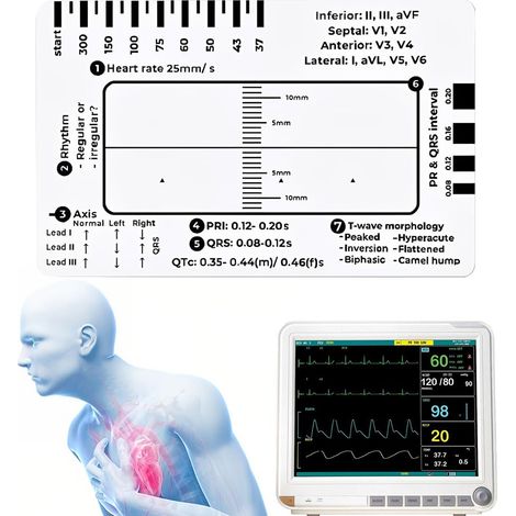 Righello ECG a 7 fasi, Righello ECG a 7 fasi, Scheda righello ECG/EKG a 7 fasi per l'interpretazione ECG/EKG, Segui un piano in 7 fasi, Calibro ECG trasparente Strumento di misurazione, Strumento di v