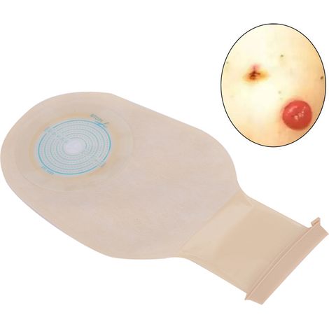 10 pièces Pochette de Colostomie Ouverte et Douce, Jetable pour Peau Sensible (1/5)